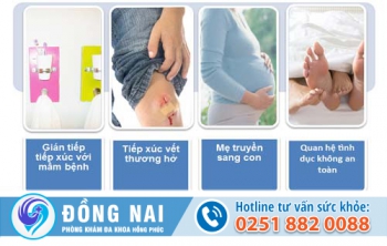 Những nguyên nhân mắc bệnh sùi mào gà