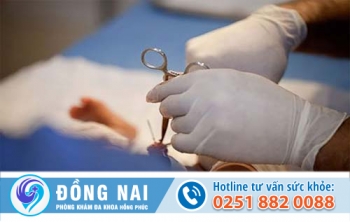 Những lợi ích của cắt bao quy đầu mang lại là gì?