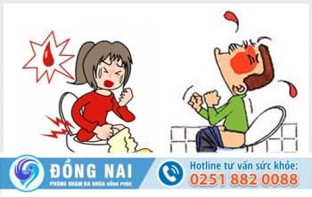 Phương pháp chữa trĩ hiệu quả và tiên tiến nhất hiện nay