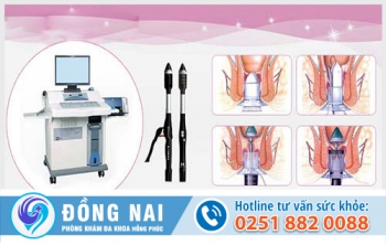 Phương pháp điều trị bệnh trĩ hiệu quả hiện nay