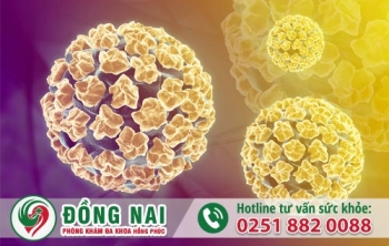 Sùi mào gà là bệnh gì?