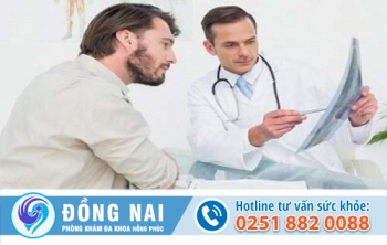Sùi mào gà nam giới và phương pháp hỗ trợ điều trị hiệu quả