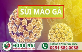 Sùi mào gà qua từng giai đoạn