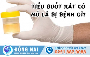 Dấu hiệu tiểu buốt kèm mủ là bệnh gì?