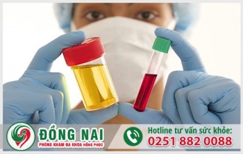 Tiểu ra máu có nguy hiểm không - Điều trị ở đâu tốt tại Biên Hòa?