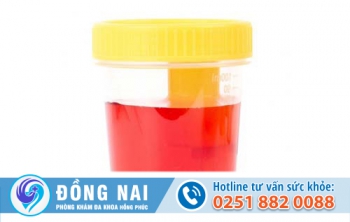 Hiện tượng tiểu ra máu sau khi quan hệ