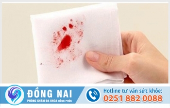 Triệu chứng bệnh ỉa ra máu
